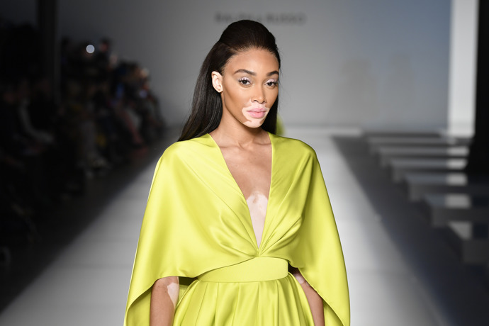 Modelka Winnie Harlow trpí kožním onemocněním jménem Vitiligo.
Modelka Winnie Harlow trpí kožním onemocněním jménem Vitiligo.