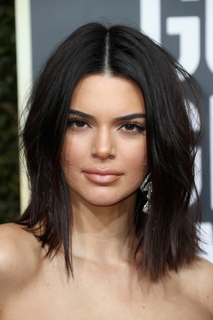 Modelka Kendall Jenner v minulosti trpěla aknózní pletí.
Modelka Kendall Jenner v minulosti trpěla aknózní pletí.