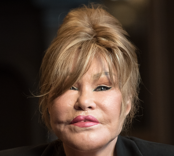 Jocelyn Wildenstein po mnoha plastikách