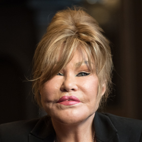 Takhle známe Jocelyn Wildenstein, známou jako „kočičí ženu".
