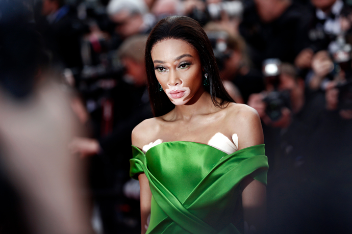 Winnie Harlow
