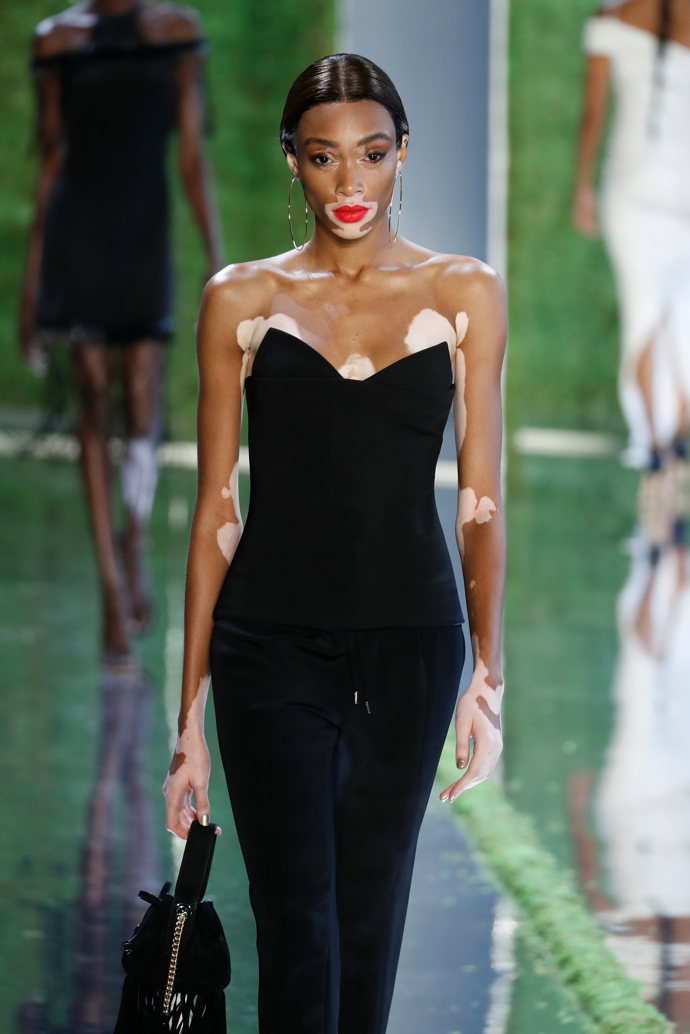 Winnie Harlow
