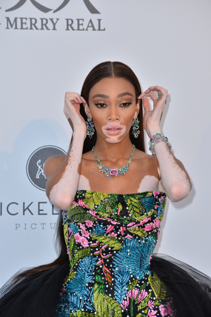 Winnie Harlow