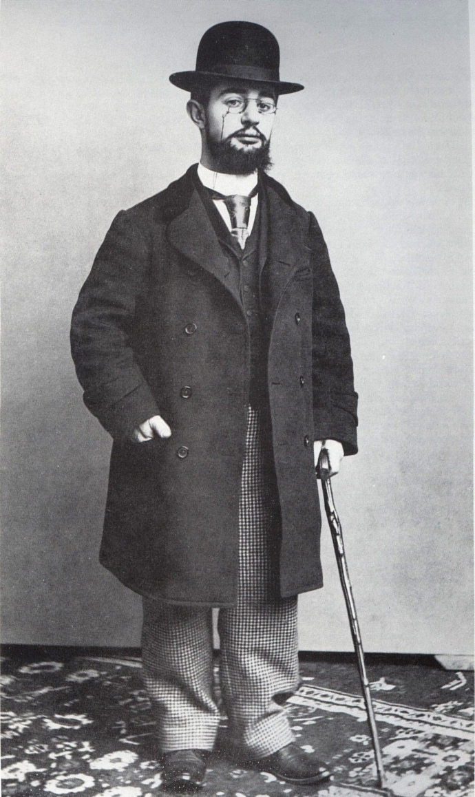 Henri de Toulouse-Lautrec onemocněl syfilidou, která přispěla k jeho předčasné smrti v 36 letech​. Z jeho obrazů noční Paříže​ je jasné, že ženy miloval.