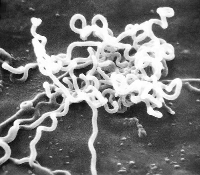 Bakterie Treponema pallidum způsobující syfilis
Bakterie Treponema pallidum způsobující syfilis