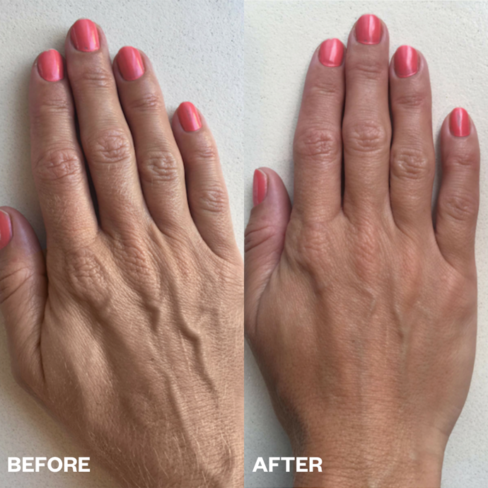 Wrinkles Schminkless Wrinkles Schminkless