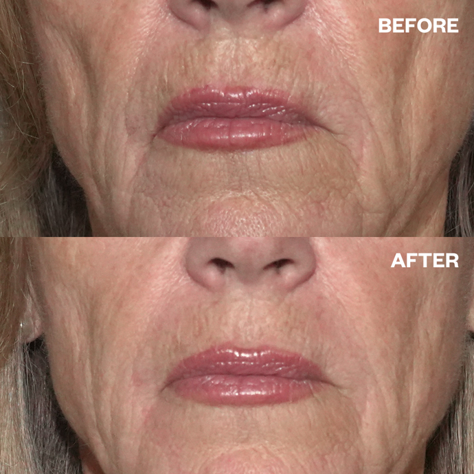 Wrinkles Schminkless Wrinkles Schminkless