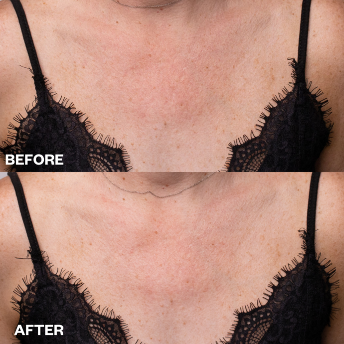 Wrinkles Schminkless Wrinkles Schminkless