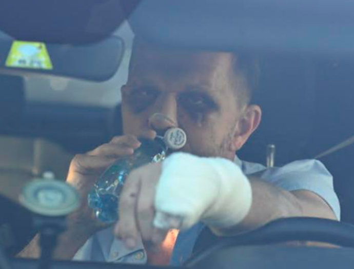 Soukup vypadá, jak když ho přejel náklaďák a ne zbil jeden chlap
