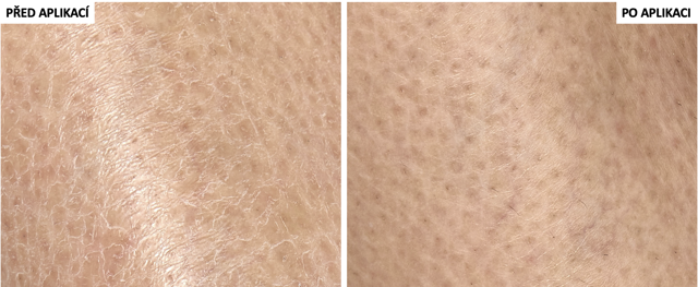 Pokožka před aplikací a po aplikaci