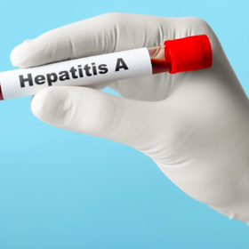 S hepatitidou A se můžeme setkat po celém světě, vyšší riziko nákazy je pak spojené především se zeměmi s nízkým hygienickým standardem. 
