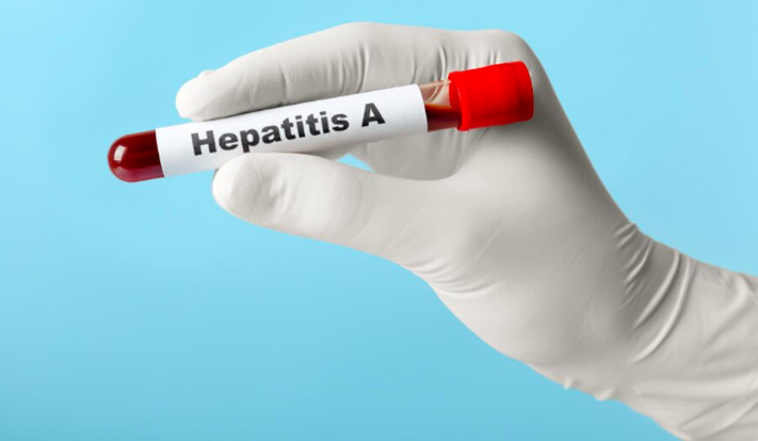 S hepatitidou A se můžeme setkat po celém světě, vyšší riziko nákazy je pak spojené především se zeměmi s nízkým hygienickým standardem. 
