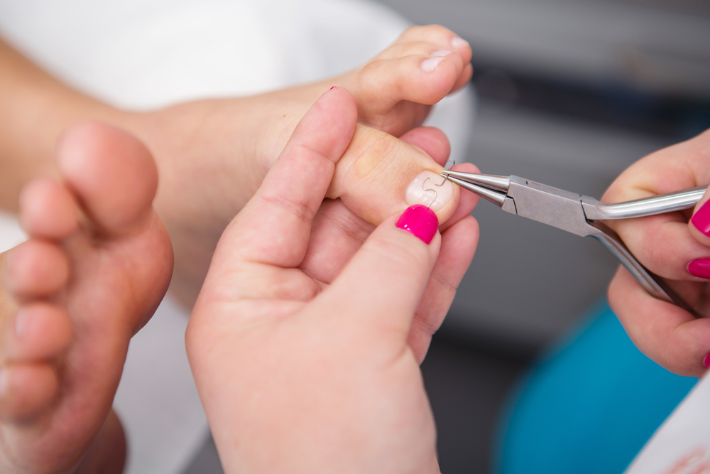 Zarůstají vám nehty? V zimě častý problém. Podoložka doporučuje snadný test, jak zjistit, zda nosíte správné boty