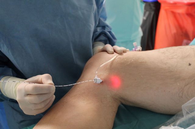 Krásné a lehké nohy po celý rok. Moderní léčba křečových žil je dnes šetrná i rychlá