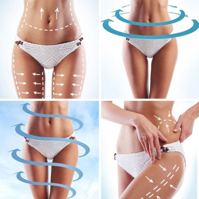 Klinika Aesthevita liposukce klasicka nebo BodyTite