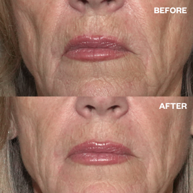 Wrinkles Schminkless Wrinkles Schminkless