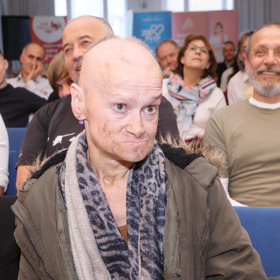 Velká zkušenost s drogami se Kornové vepsala do tváře
