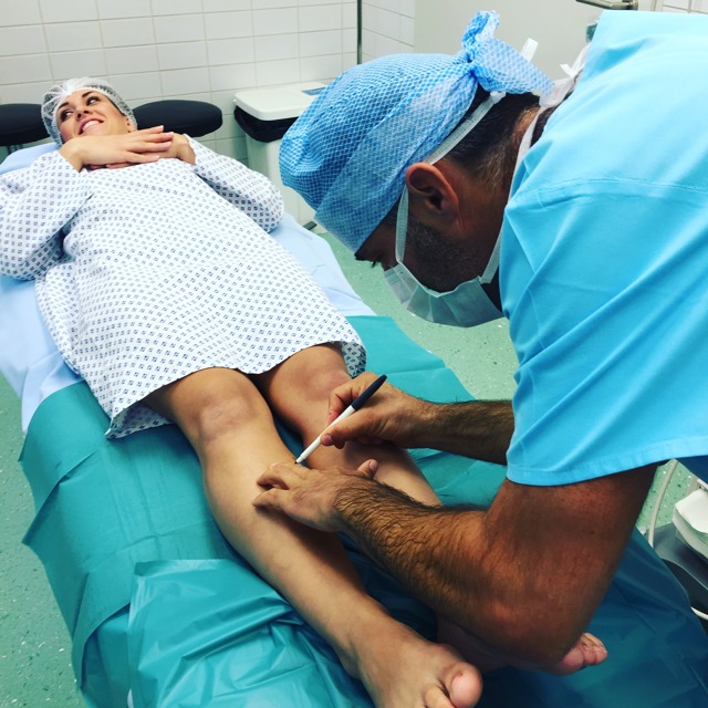 Operace křečových žil nemusí být strašák Operace křečových žil nemusí být strašák