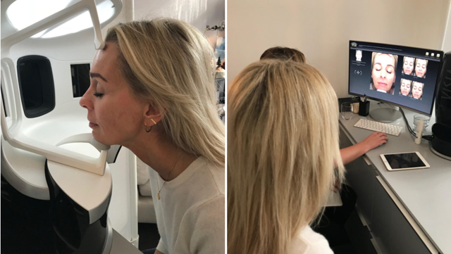 OSLO SKIN LAB: Ještě lepší výsledky po roce užívání! OSLO SKIN LAB: Ještě lepší výsledky po roce užívání!