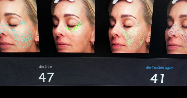 OSLO SKIN LAB: Ještě lepší výsledky po roce užívání! OSLO SKIN LAB: Ještě lepší výsledky po roce užívání!