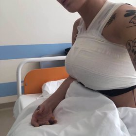 Tohle jsou nová prsa Daisy Lee.