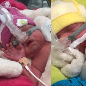 Trojčata musí být ještě nějaký čas na přístrojích a pod dohledem lékařů.