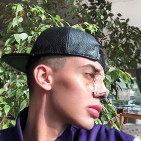 Bez úprav už si nedovede představit život.