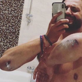 Marián Čekovský měl nehodu na motorce, naštěstí vyvázl jen se spoustou škrábanců.