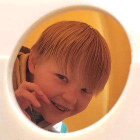 Trpěl poruchou močového měchýře a bylo potřeba hlídat jeho příjem vody.