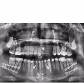 Kdyby na operace nešel, mohl mít trvalé následky.
