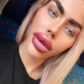 Své rty plánuje ještě zvětšovat. 