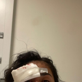 Tereza Nguyenova vypadá dost špatně. 