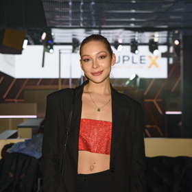 Veve ukázala, že má po reality show Farma Česko tělo samou modřinu.