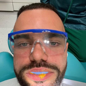 Freescoot se rozhodl pro zirkonové korunky na zuby. 