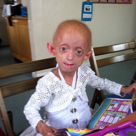 Ashanti nakonec svůj boj se syndromem prohrála.