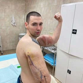 Kirill Tereshin touží po záchraně svých paží.