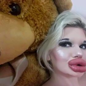 Andrea Ivanova má největší rty světa: S výplněmi nekončí