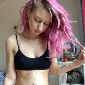 Lucie Levá roky bojovala s bolestmi břicha, které její obvodní lékařka bagatelizovala.