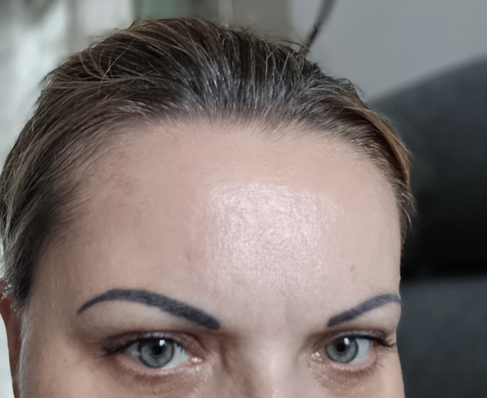 Moje mračivka začala být méně viditelná desátý den.