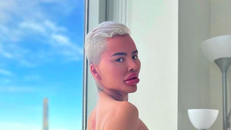 Galerie: Mateo Blanco: Harazd se zdravím kvůli touze po dokonalosti