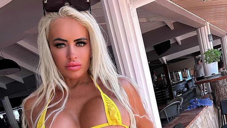 Galerie: Gitte Von G si nechala upravit přirození. Klín má ve stylu