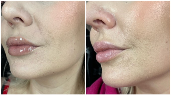 Na snímku vidíte tvář hned po nalíčení Lasting Finish, včetně pudrování a po 10 hodinách na obličeji. Žádné další pudrování během dne jsem při testu neprováděla. 