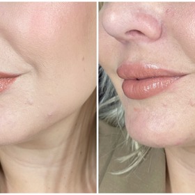 Na snímku vidíte tvář hned po nalíčení Studio Fix Every-wear All-over face pen, včetně pudrování a vpravo po 10 hodinách na obličeji. Žádné další pudrování během dne jsem při testu neprováděla. 