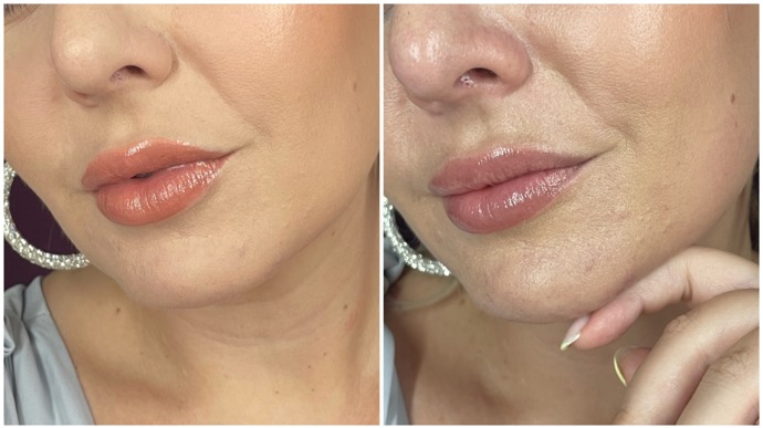 Na snímku vidíte tvář hned po nalíčení All Hours, včetně pudrování a vpravo po 10 hodinách na obličeji. Žádné další pudrování během dne jsem při testu neprováděla. 