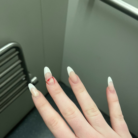 Umělý nehet si po nárazu do tvrdé plochy vrazila do vlastního a způsobila si nepříjemné a bolestivé trápení.