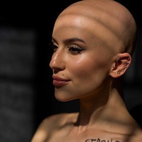 Vše odstartovalo asi rok po operativním zvětšení prsou. Vedle alopecie trápily Barboru bolesti kostí a kloubů, začala mít rozmazané vidění, špatně se jí dýchalo. K tomu se přidalo píchání a pálení v prsou, pnutí, ekzém v okolí ňader, zvětšené lymfatické uzliny, únava, mravenčení končetin, brnění brady, tik v oku a suché oči.