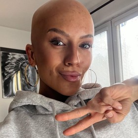 Nakonec si Barbora nechala implantáty odstranit a její zdravotní stav se okamžitě zlepšil. Sice pořád neví, zda jí někdy narostou vlasy, ale vlastně jí podle jejích slov ani nechybí. Už si na sebe zvykla.