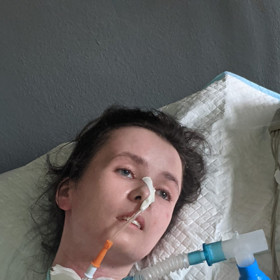 Lidé mohou Petře přispět na léčbu.