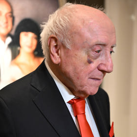 Felix Slováček se postupně zbavuje svého monoklu.