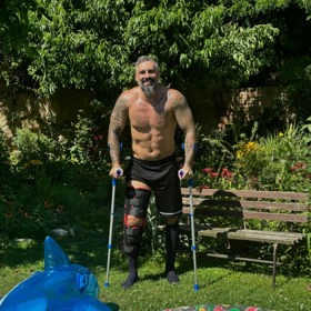 Život se Pepovi zkomplikoval ještě ošklivým úrazem nohy.